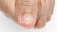 Kada je vrijeme ići doktoru: Imate vodoravne ili okomite nabore na noktima?