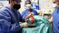 Dva mjeseca poslije, preminuo prvi čovjek kojem je transplantirano srce svinje