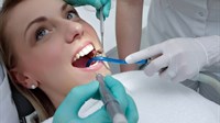 Popraviti zube i do 75 posto jeftinije u nas nego u Njemačkoj